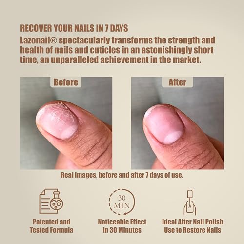 Nail Strengthening & Repair Gel, Restores Brittle Nails from Damage Caused by Manicures & Harsh Environments, Infused with 94% Walnut Extract, Honey Colored