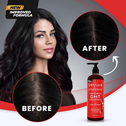 Anti-Hair Loss Shampoo With Biotin, for Men & Women - Sulfate-Free, Natural DHT Blocking Formula for Hair Growth, Thinning Hair Prevention, 16 Oz