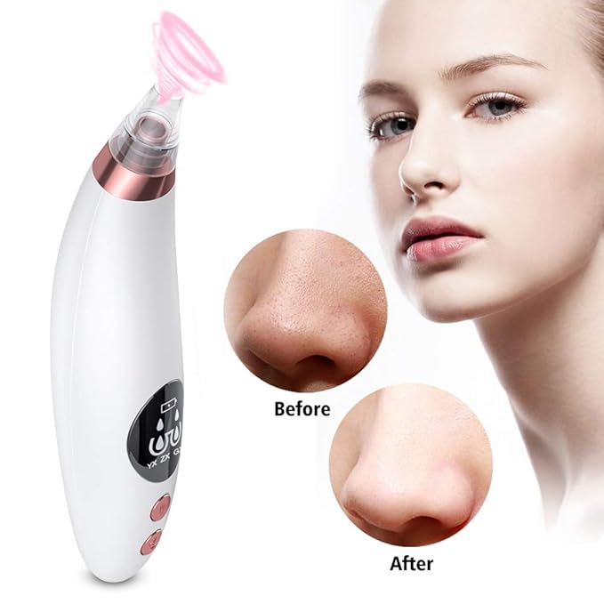Yafei Pore Vacuum Removed Blackheads 2021 Upgraded Strong Suction Rechargeable Removing Black Heads USB Rechargeable Blackhead Removal Pimple for Women & Men Gray