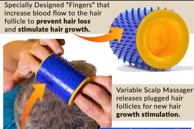 MagnaRoller Scalp Massager for Hair Growth - Hair Loss Treatment for Men and Women with Thinning, Dry and Dull Hair - Increases Blood Flow to Scalp & Hair follicles for Thicker, Healthier Hair.