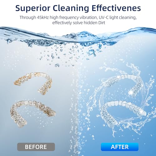 Ultrasonic Retainer Cleaner, Retainer Cleaner Machine for Dentures, Mouth Guards, Braces, Toothbrush Heads, Jewelry with 200ML Capacity, 45kHz Retainer Cleaning, 4 Modes for All Dental Appliances