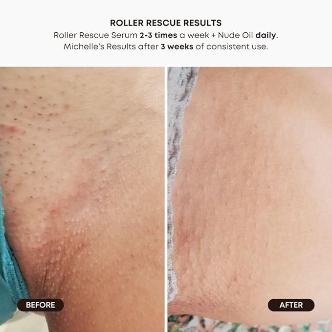 Bushbalm Ingrown Hair Routine - Roller Rescue, Nude Oil and Nude Scrub Bundle - AHA & BHA - Exfoliating, Soothing, Cooling for Intimate Areas, Underarms - Helps With Razor Bumps, Ultimate(Trio Bundle)