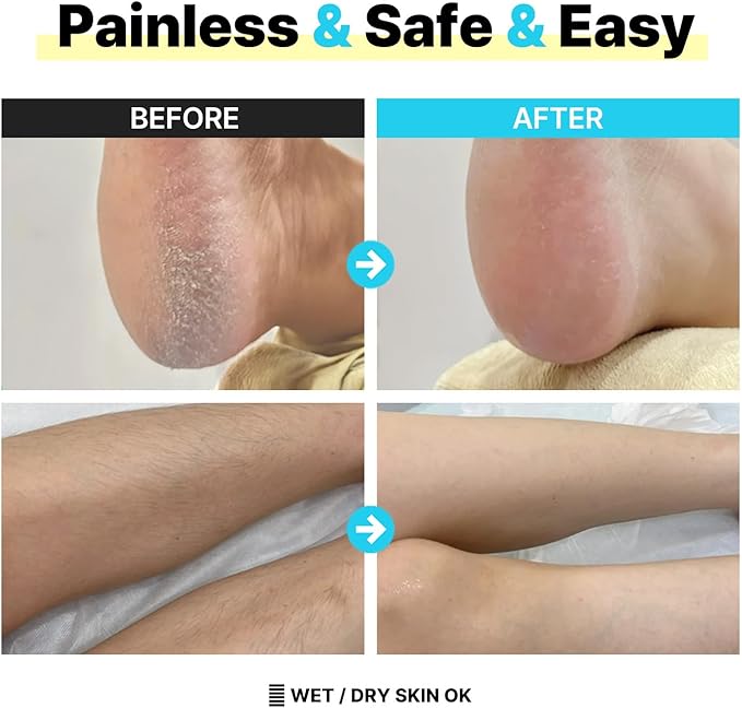 BODLOV Duo, Callus Removal and Hair Erase in ONE, Nano Glass, Foot File, Wet and Dry Skin, Skin Painless and Safety, Water Washing, Ergonomic Design, Hygiene to USE, Dual Care, Exfoliation, 2 in 1