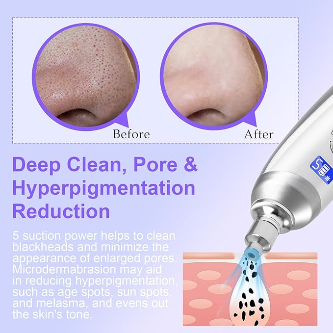 Personal Microdermabrasion Machine, Rechargeable Suction Microderm Facial Device with 9pcs Diamond Dermabrasion Head and 5 Levels for Professional Face & Body Skin Care Salon Home Use