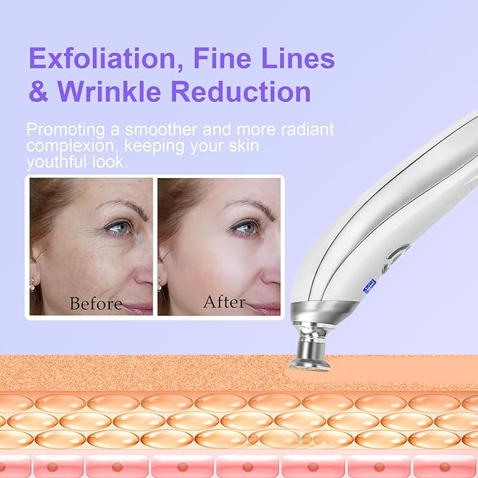 Personal Microdermabrasion Machine, Rechargeable Suction Microderm Facial Device with 9pcs Diamond Dermabrasion Head and 5 Levels for Professional Face & Body Skin Care Salon Home Use