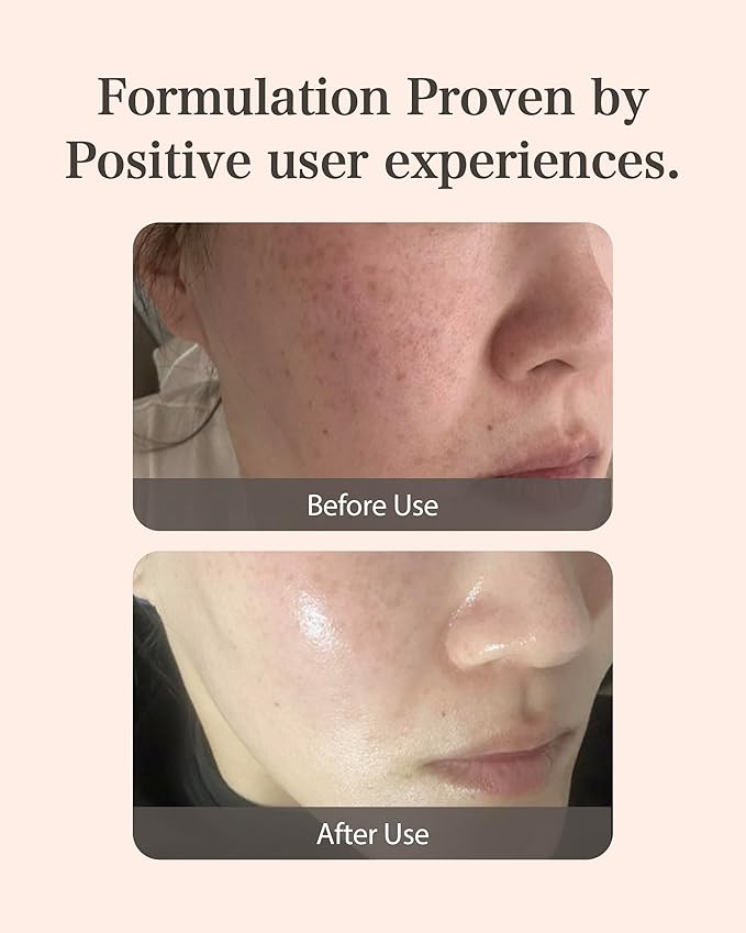 MASTINA Mastic Ampoule Serum Spoid Type Set(Dropper Type, 0.5fl oz, pack of 2),Fermented Mastic Gum. White Mastic Complex 63% + Tranexamic Acid 2% + Niacinamide 5%