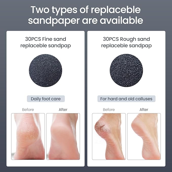 Electric Foot Callus Remover- Electric Callus Remover for feet,Adjustable Speed Foot Filer with 60 Pcs Sandpaper Discs for Men & Women Dead Dry Calluses and Cracked Heels,Professional Pedicure Tool