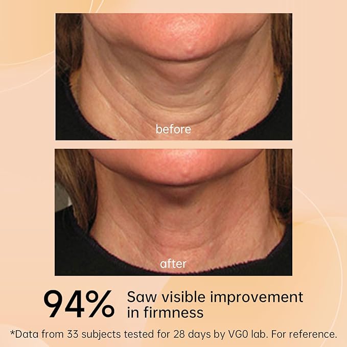 VGO Neck Firming Cream - Anti-Aging & Wrinkle Smoothing for Neck & Décolleté with Polypeptides, Retinol & Hyaluronic Acid - Lifts & Evens Skin Tone. 4.23 Fl Oz