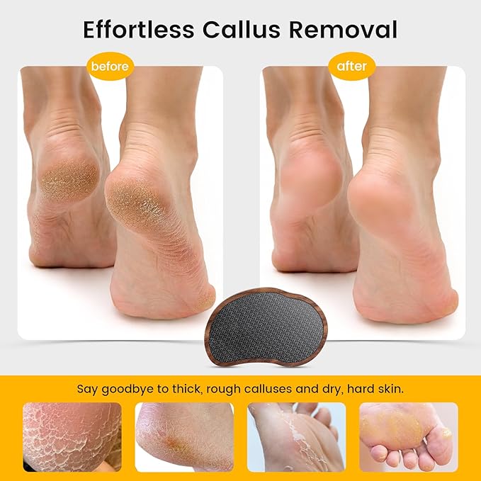 BEZOX Glass Foot Scrubber(1 PCS) - Nano-Glass Pedi Egg Pumice Stone for Feet Dead Skin, Plastic-Free Pedicure Foot File Callus Remover for Silky Smooth Feet - Walnut Wood Handled