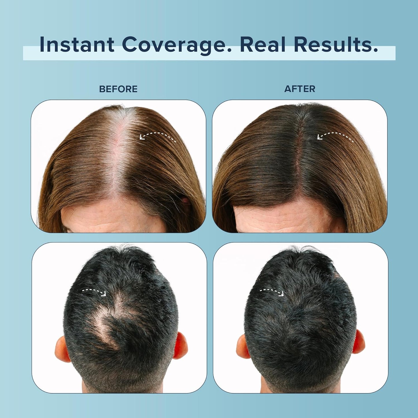 TRUHAIR Color Fibers Root Coverage & Density Booster | Quick-Apply Root Touch Up Hair Color | Natural Color Matching, Hair Cover up to Color Gray Roots - 11 Hair Colors Available (Gray)